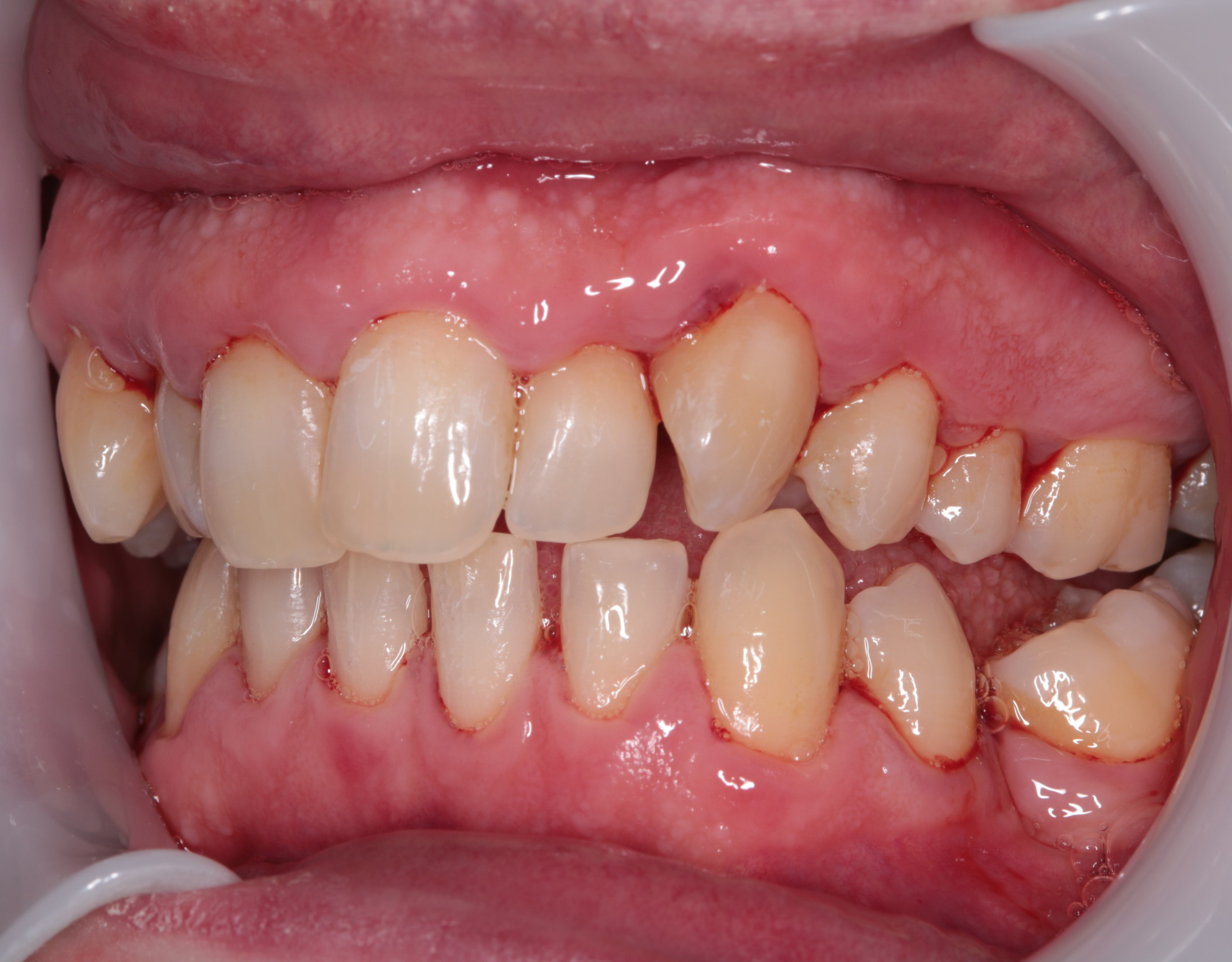 Getting to grips with general dental practitioner orthodontics